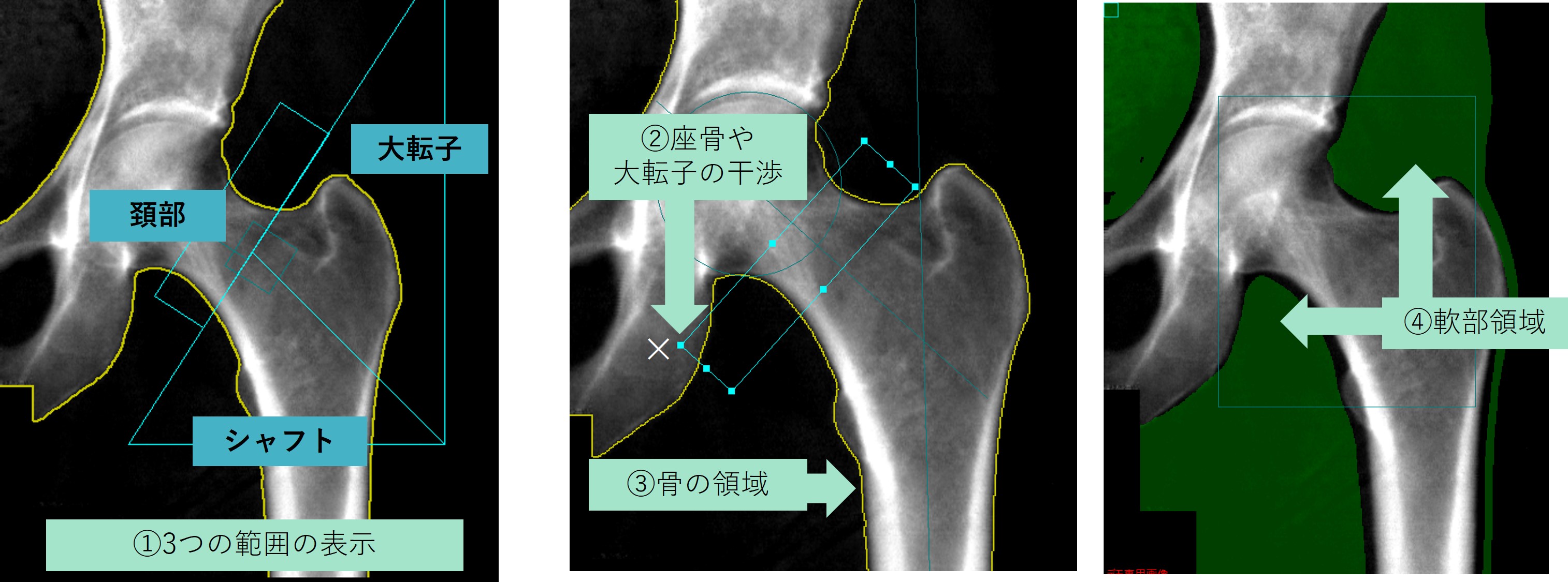 Technical Tips_term04.jpg